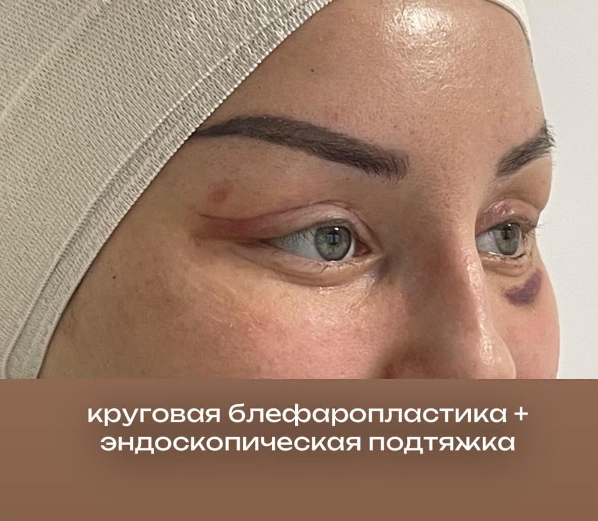 До